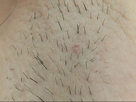 300人の腋 2　サンプル画像06